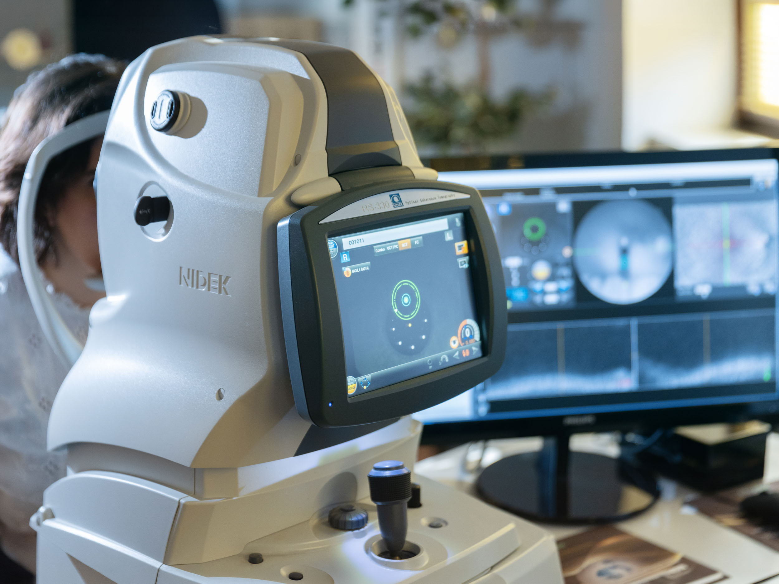 OCT posteriore con Fundus Camera (Nidek Retina Scan Duo RS-330)